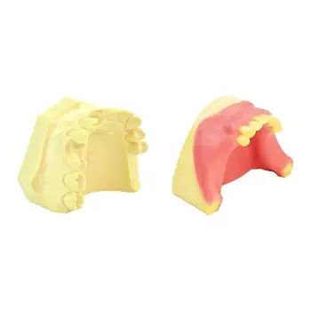 Модель стоматологической имплантации Верхнечелюстные зубы с зубной имплантацией Модель стоматологического лабораторного инструмента
